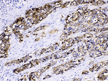 Polyclonal Rabbit anti-Human KRT5 / CK5 / Cytokeratin 5 Antibody (IHC, WB)