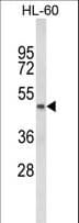 PTGER2 / EP2 Antibody (aa118-147)