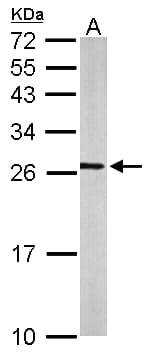 Polyclonal Rabbit anti-Human RALA / RAL Antibody (aa1-206, WB)