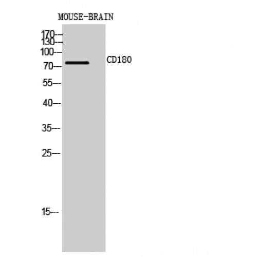RP105 / CD180 Antibody (221-270 aa, Internal)