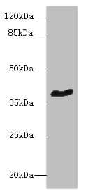 GPCRW / GPR18 Antibody