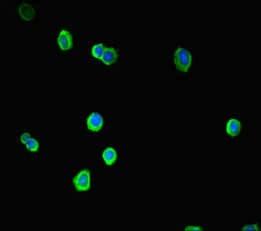 Polyclonal Rabbit anti-Human SOX14 Antibody (IHC, IF, WB)