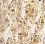 PDGFRB / PDGFR Beta Antibody