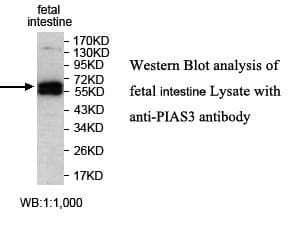PIAS3 Antibody (aa274-521)