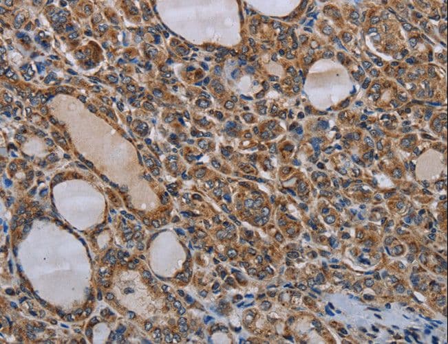 Polyclonal Rabbit anti-Human MT-ND6 Antibody (IHC)