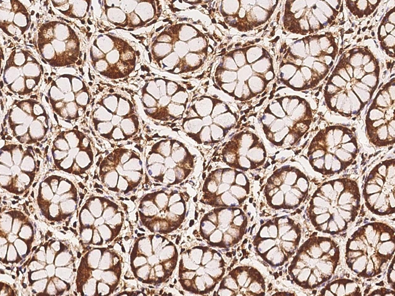 Polyclonal Rabbit anti-Human MFSD11 / ET Antibody (IHC)