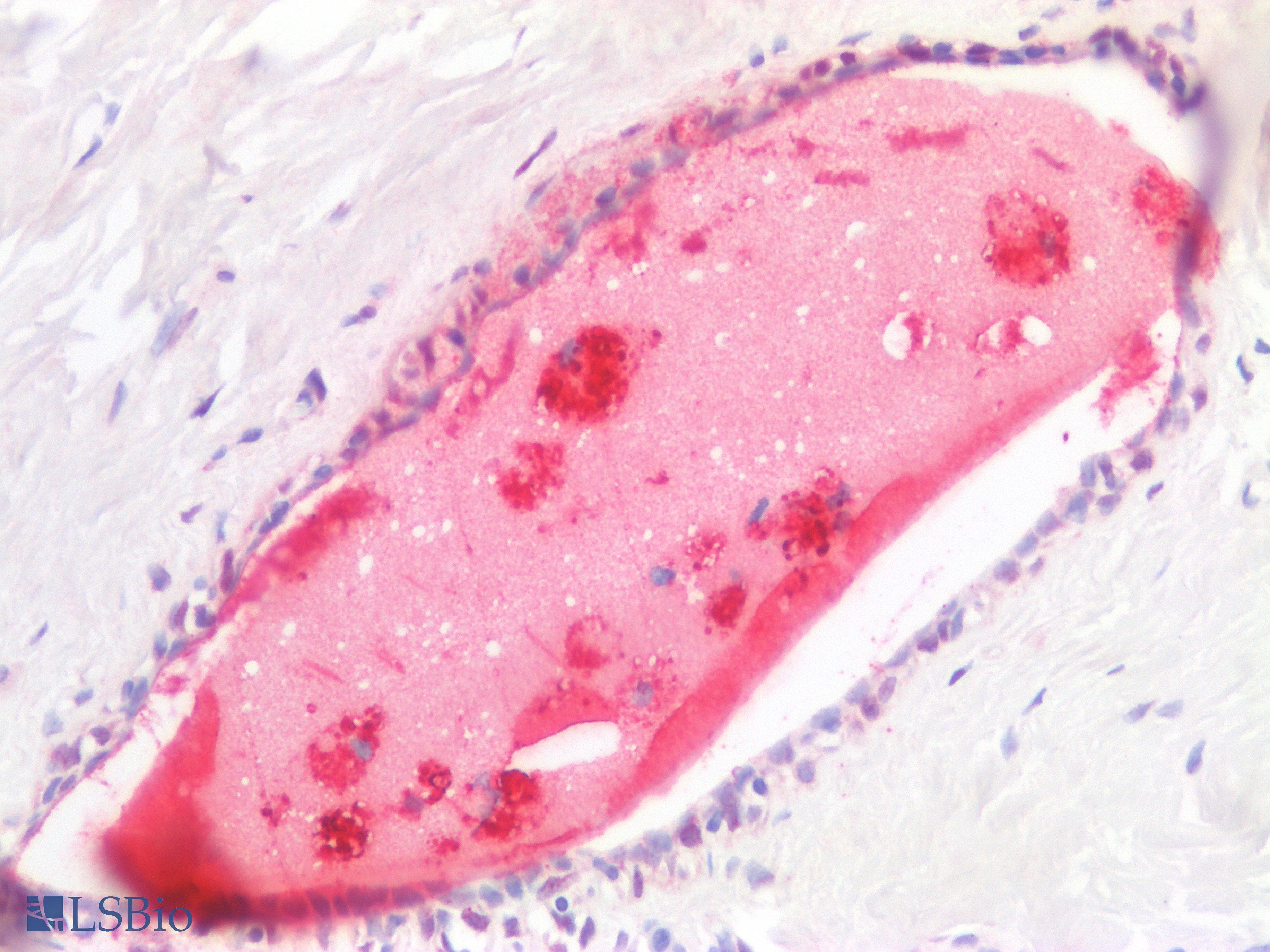PathPlus™ SCGB2A2 / Mammaglobin A Antibody