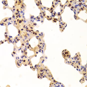 PHAP1 / ANP32A Antibody