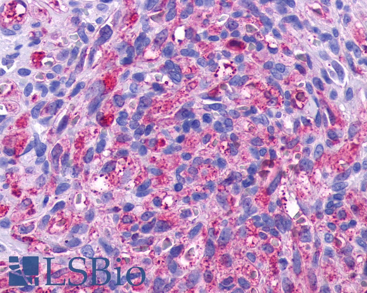 PathPlus™ ADGRA2 / GPR124 Antibody (N-Terminus)