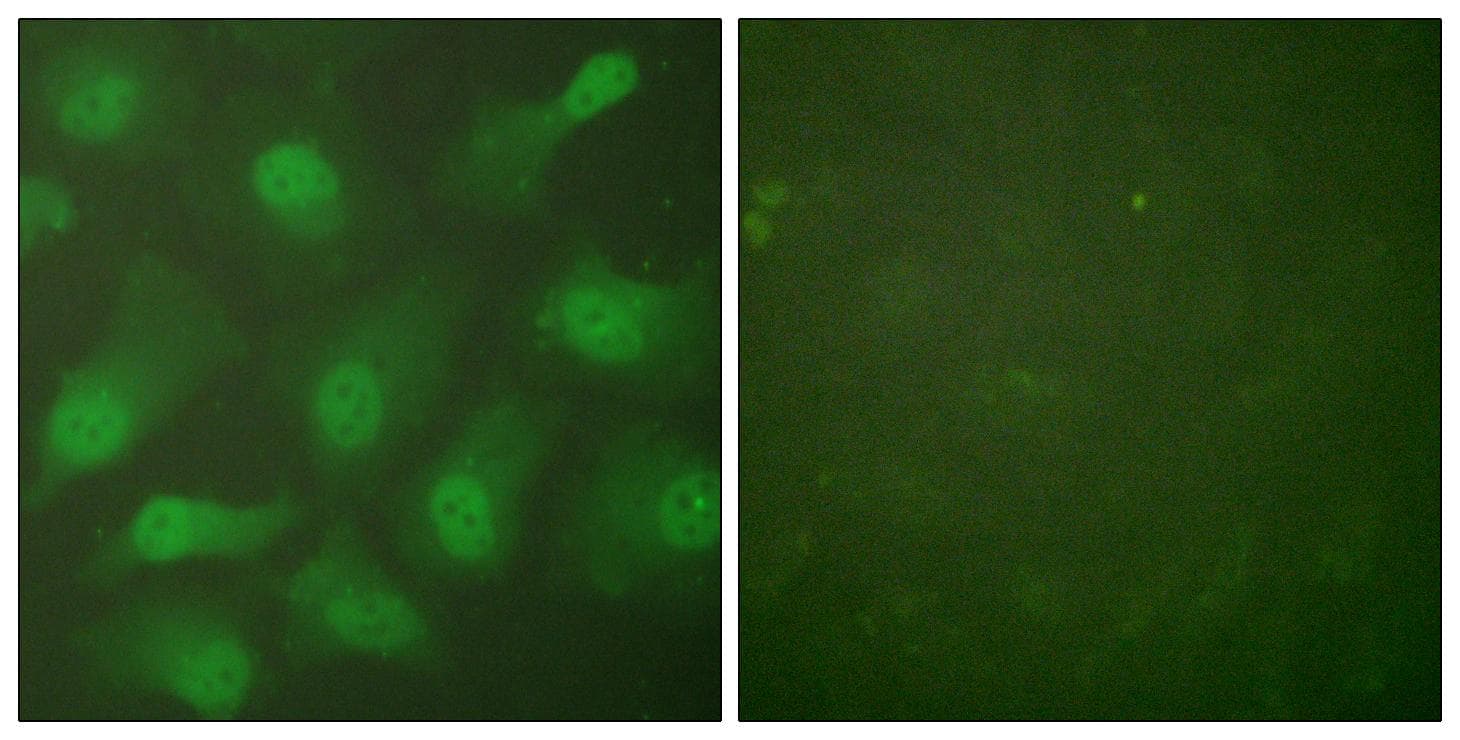 Polyclonal Rabbit anti-Human CSE1L Antibody (IHC, IF, WB)