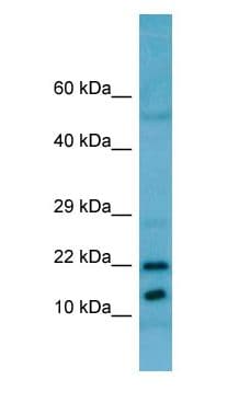 RPL11 / Ribosomal Protein L11 Antibody (C-Terminus)