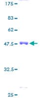 Human HMGCLL1 Protein (Recombinant GST)