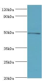 Polyclonal Rabbit anti-Human ECSIT Antibody (aa185-431, IHC, WB)
