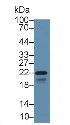 CAV1 / Caveolin 1 Antibody (aa2-104, Cy3)