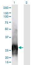CALB1 / Calbindin Antibody (clone 1F6)