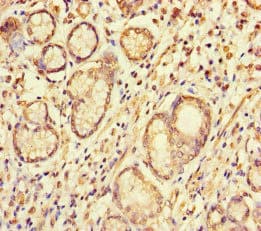 S100G / CABP9K Antibody
