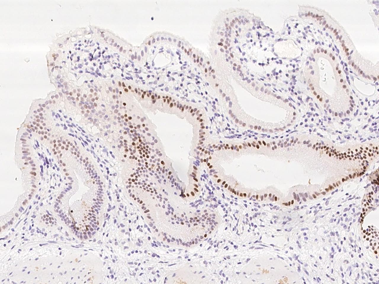 KLF6 Antibody