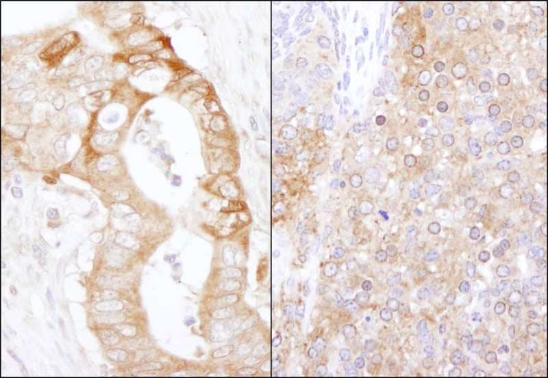 EEF2K Antibody (aa675-725)