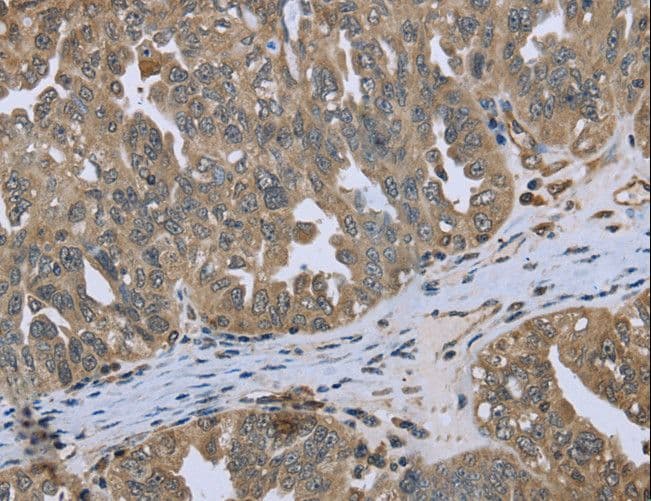 Polyclonal Rabbit anti-Human DCTN4 / Dynactin 4 Antibody (IHC)