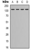 LEPR / Leptin Receptor Antibody (Internal)