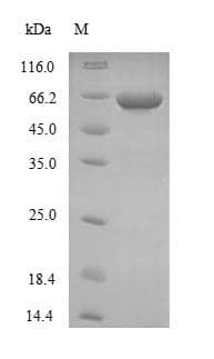 Human NME4 Protein (Recombinant GST, N-terminus)