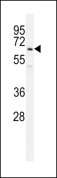 UBFD1 Antibody (aa1-30)