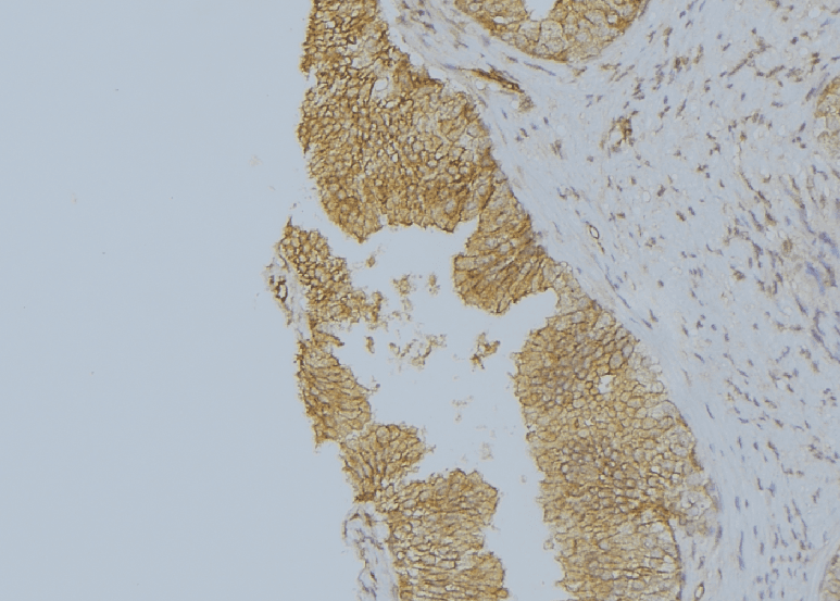 KRT9 / CK9 / Cytokeratin 9 Antibody
