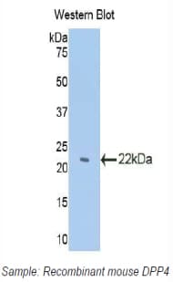 Polyclonal Rabbit anti-Mouse DPP4 / CD26 Antibody (aa29-178, WB)