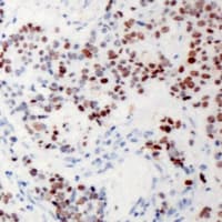 Polyclonal Rabbit anti-Human XRN2 Antibody (N-Terminus, IHC, WB)