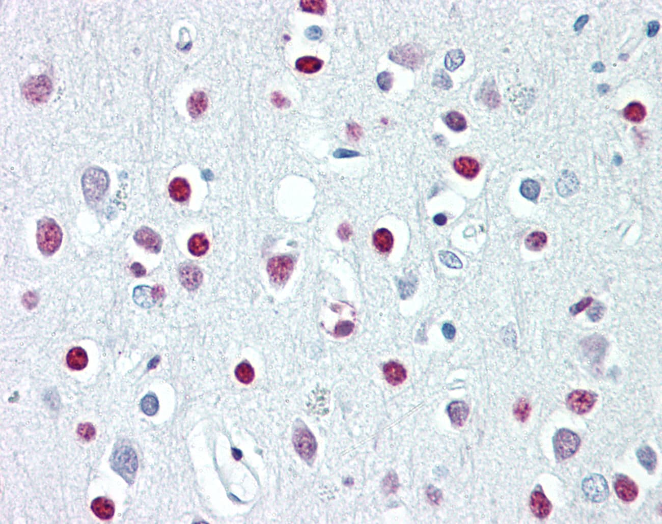 WHSC1 / NSD2 Antibody (aa219-268)