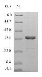 Human HBXIP Protein (Recombinant GST, N-terminus)