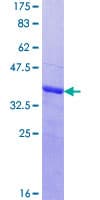 Human MAGEC1 Protein (Recombinant GST, N-terminus)