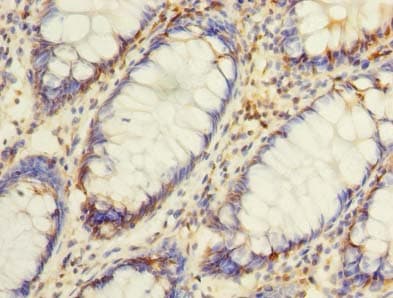 ASB8 Antibody