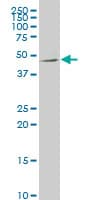 IHC-plus™ Monoclonal Mouse anti-Human NTNG2 / Netrin G2 Antibody (clone 4F11, IHC, WB)
