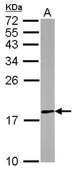 DUSP26 / MKP8 Antibody (aa22-117)