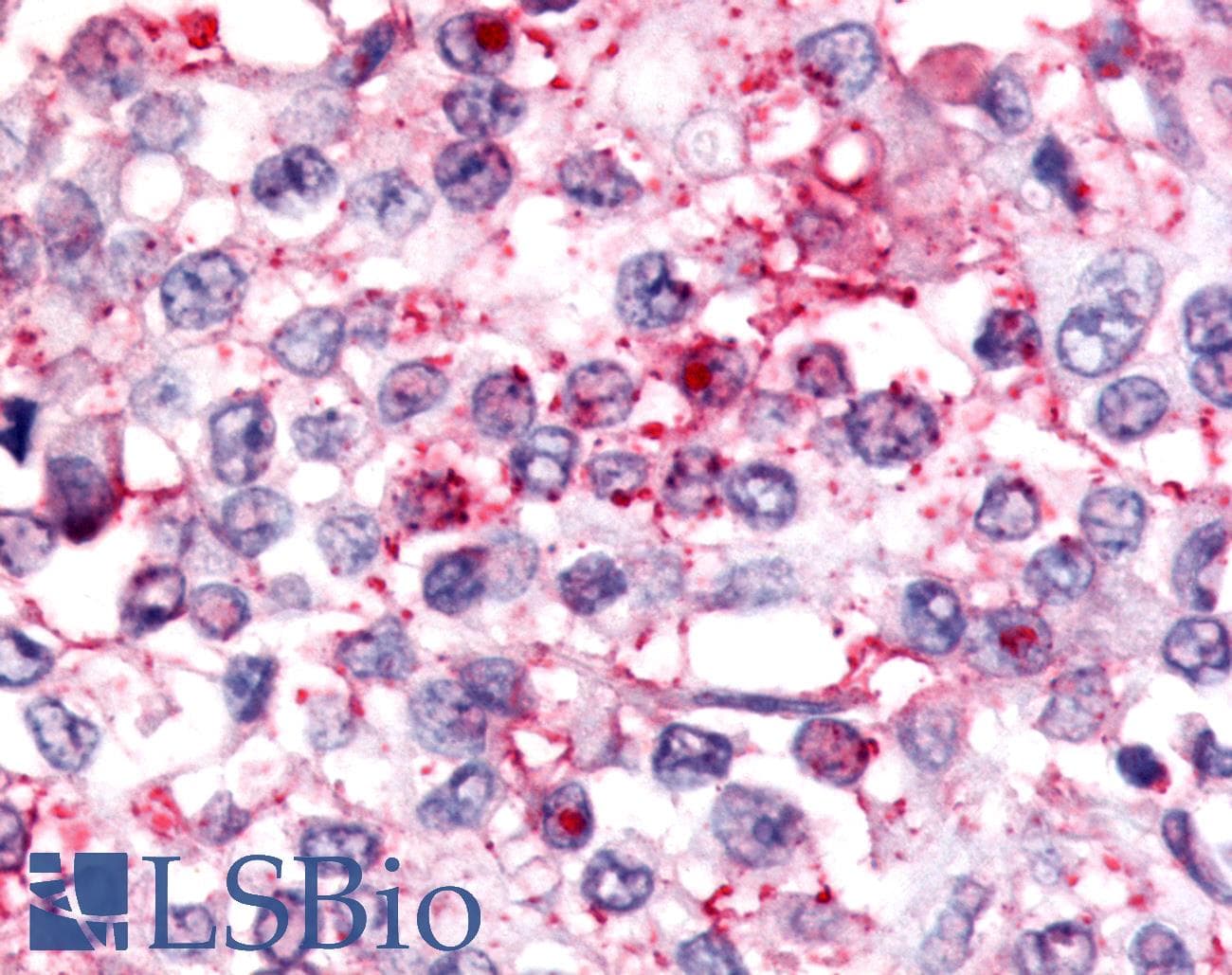 PathPlus™ Nor-1 / NR4A3 Antibody (Internal)