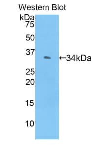 CDH3 / P-Cadherin Antibody (aa371-660, FITC)