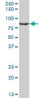 IHC-plus™ Monoclonal Mouse anti-Human RACGAP1 / MGCRACGAP Antibody (clone 1G6, IHC, WB)