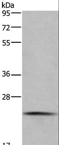 Polyclonal Rabbit anti-Human CMTM6 / CKLFSF6 Antibody (IHC, WB)