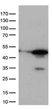 MAPK14 / p38 Antibody (aa2-360, clone OTI7H6, Carrier-free)