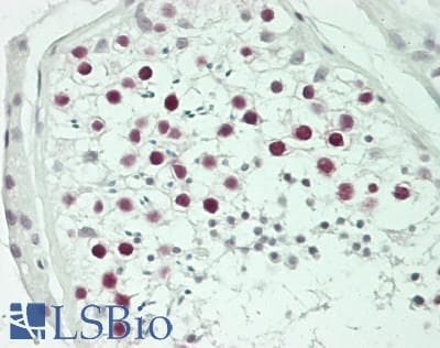 IHC-plus™ Polyclonal Rabbit anti-Human ANAPC7 / APC7 Antibody (aa515-565, IHC)