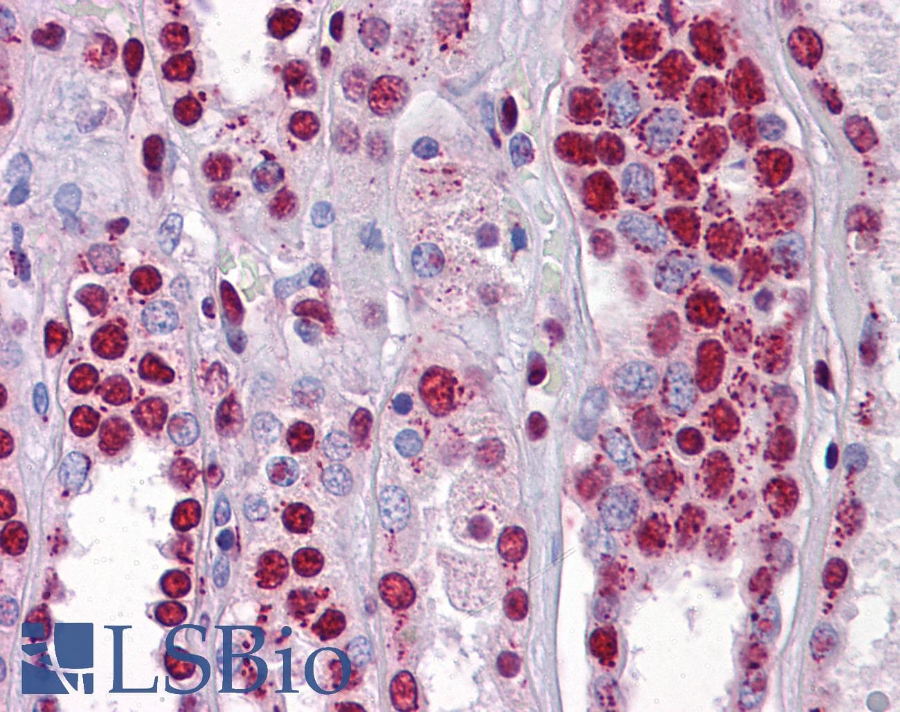 IHC-plus™ Monoclonal Mouse Polyglutamine Antibody (clone 5TF1-1C2, N-Terminus, IHC, WB)