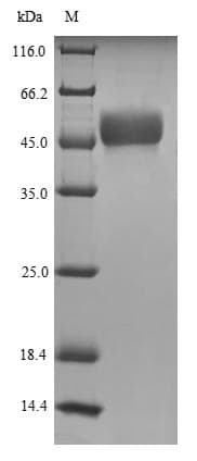 Human NXP2 / MORC3 Protein (Recombinant 6His-SUMO, N-terminus)