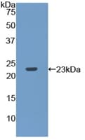 Rat RPP40 / Ribonuclease P Protein (Recombinant His, N-Terminal)
