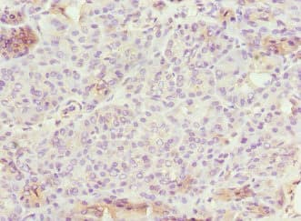 Polyclonal Rabbit anti-Human EPS15L1 / EPS15R Antibody (IHC, WB)