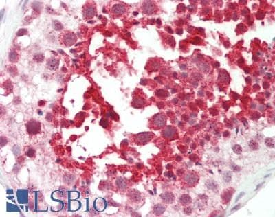 Polyclonal Rabbit anti-Human FGD1 Antibody (C-Terminus, IHC, WB)