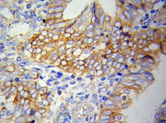 VCAM1 / CD106 Antibody