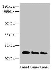 Polyclonal Rabbit anti-Human ARL8A + ARL8B Antibody (IHC, WB)
