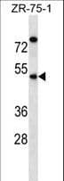 EME2 Antibody (aa249-278)