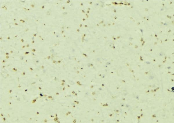 Polyclonal Rabbit anti-Human PSMC5 / SUG1 Antibody (IHC, WB)